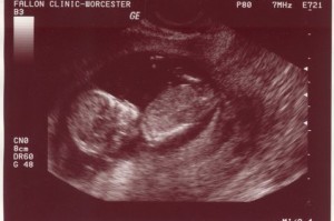 23 weken zwanger